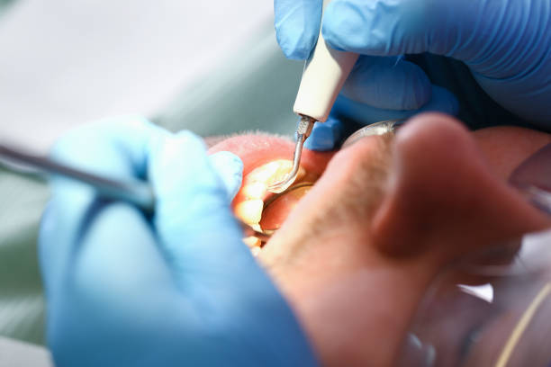Best Emergency TMJ Treatment in Wanakah, NY