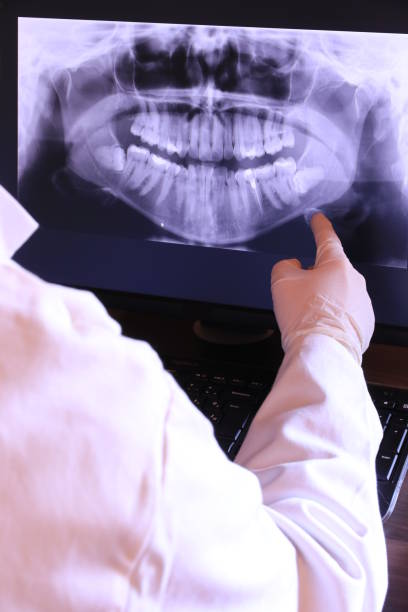 Best Emergency Denture Repair in Wanakah, NY