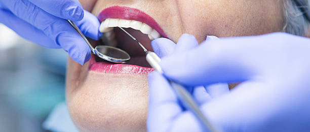 Best Emergency Treatment for Dental Infections or Abscesses in Wanakah, NY